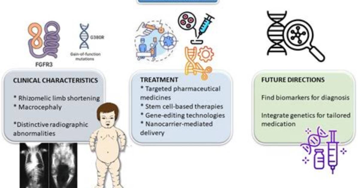 A Comprehensive Guide to Achondroplasia