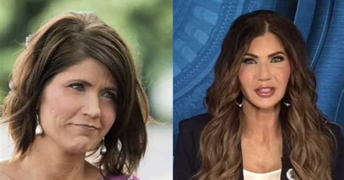 A Guide to Kristi Noem's Facelift Transformation
