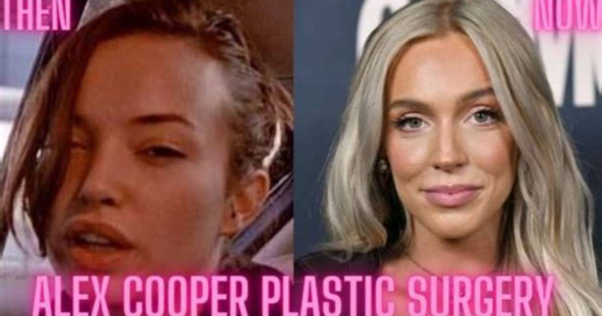 Alex Cooper Denied Plastic Surgery Rumors