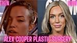 Alex Cooper Denied Plastic Surgery Rumors