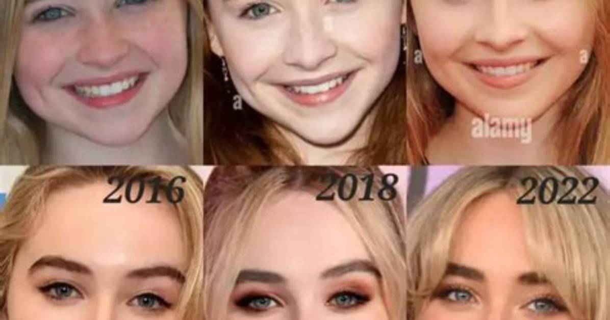 All About Sabrina Carpenter's Lip Fillers: What We Know