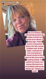 Amy Roloff's Injury: Latest Updates and Recovery Status