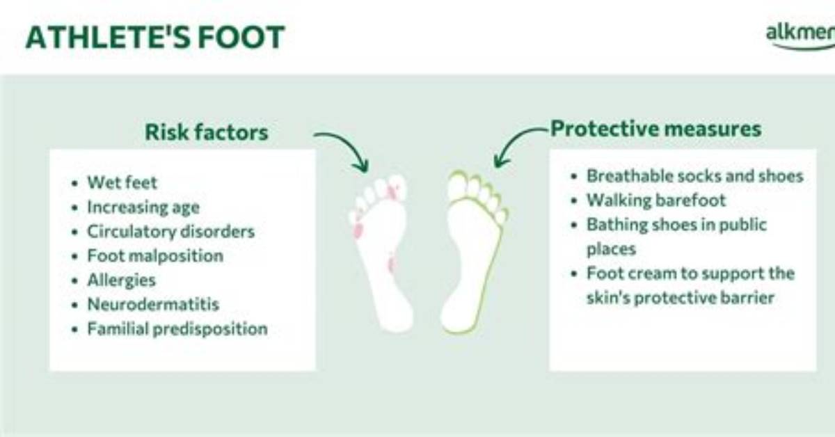Athlete's Foot Hot Tub: Prevention and Treatment