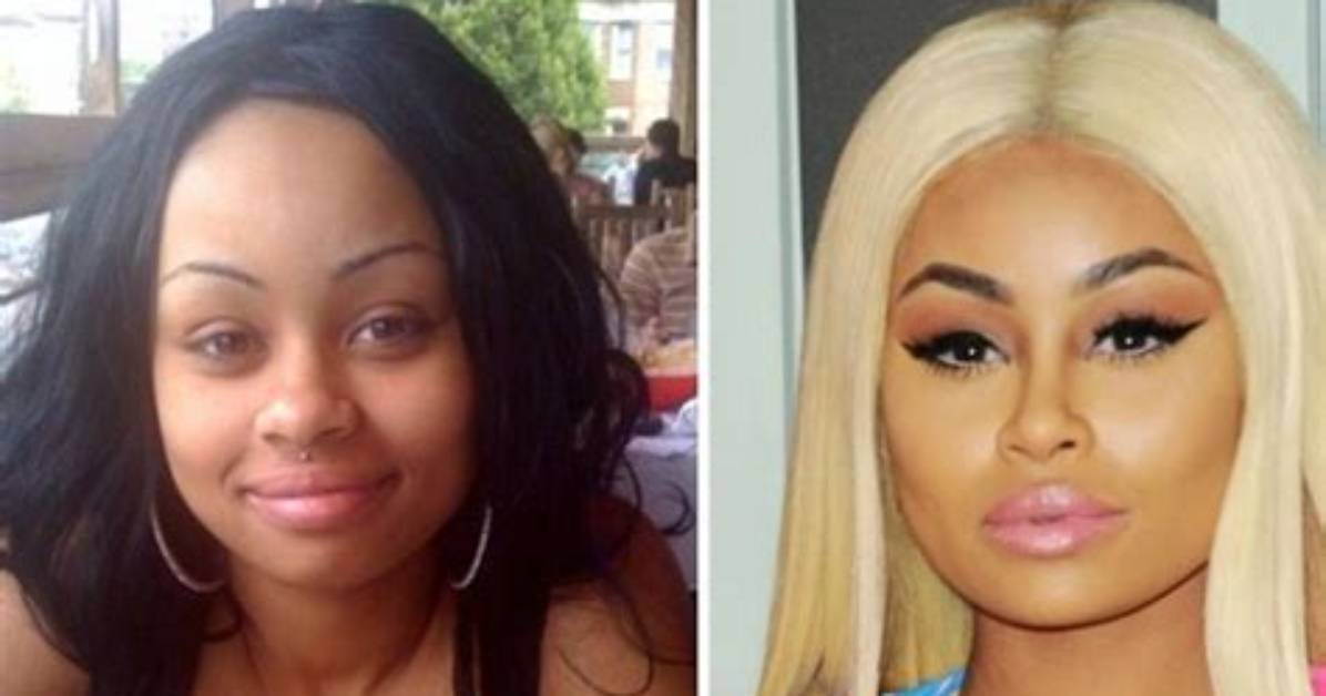 Blac Chyna’s Before and After Transformation: Explained