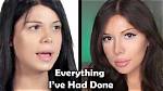 Blaire White's Transformation: Before and After Transition