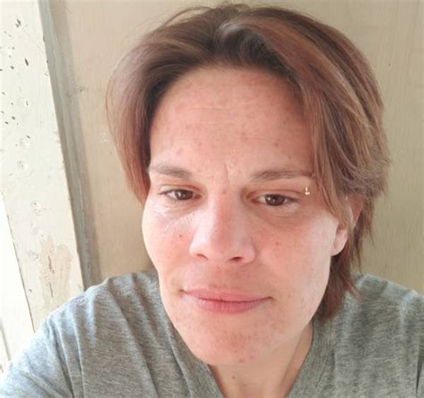 Brittany Skoland's Brave Encounter: Attacked by Dogs