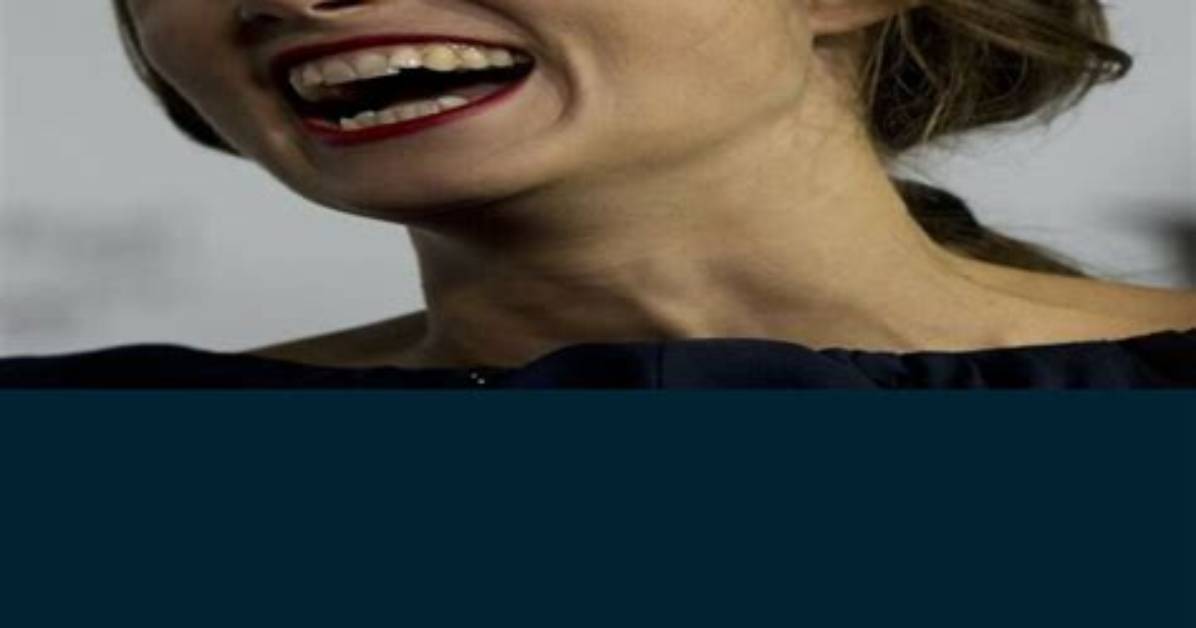 Celebrities Who Embrace Their Perfectly Imperfect Smiles