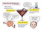 Concealed Truths: Fetal Alcohol Syndrome's Impact on Celebrities