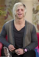 Courage and Resilience: Celebrities with Treacher Collins Syndrome