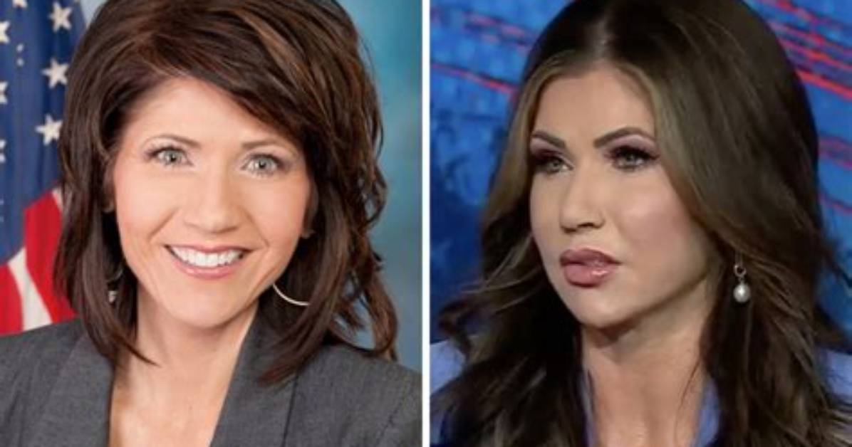 Curious About Kristi Noem's Pre-Surgery Appearance? See Photos Here