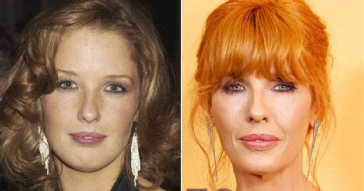 Did Kelly Reilly Get Lips Surgery? Before and After Photos