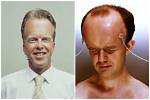 Discover the Secrets Behind the Largest Forehead in the World