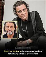 Does Ian Mcshane Have a Glass Eye? Actor Eye Related Injury and Condition Described
