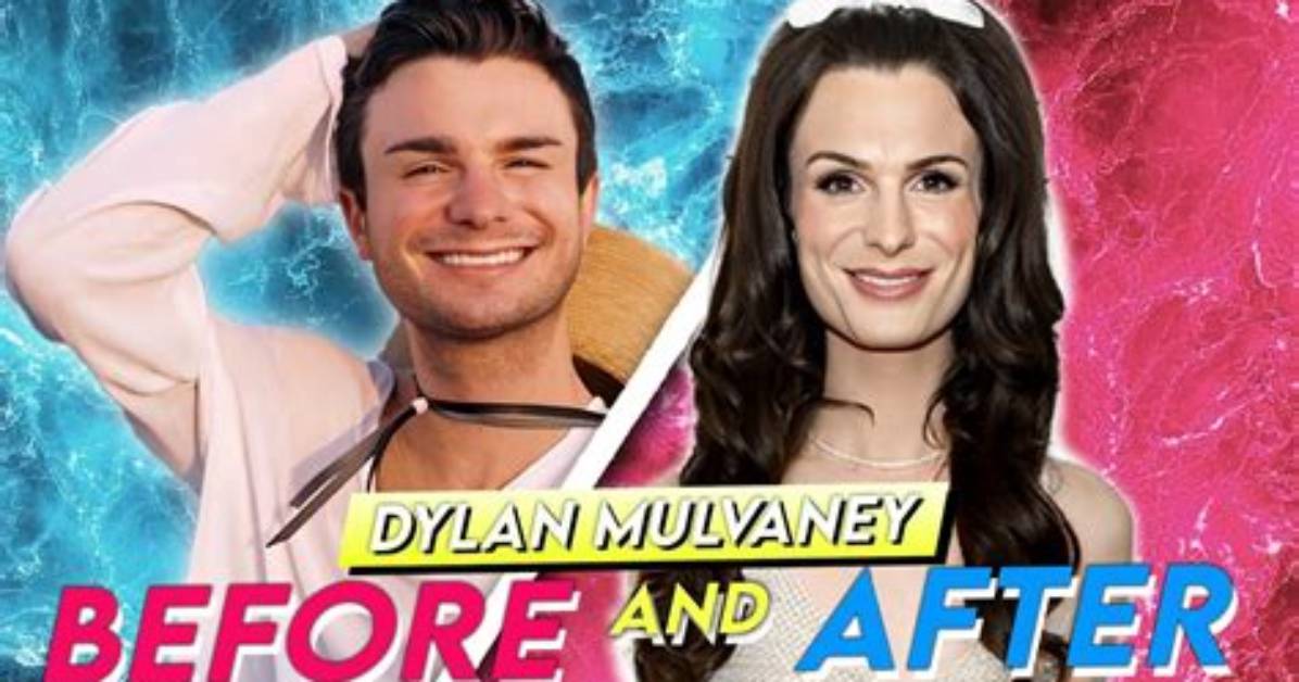 Dylan Mulvaney Weight Loss Before and After: Plastic Surgery and Transformation