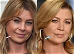 Ellen Pompeo's Lip Filler Journey: a Closer Look
