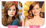 Emma Booth Plastic Surgery Before and After: Outlast Cast Accident and Health Update