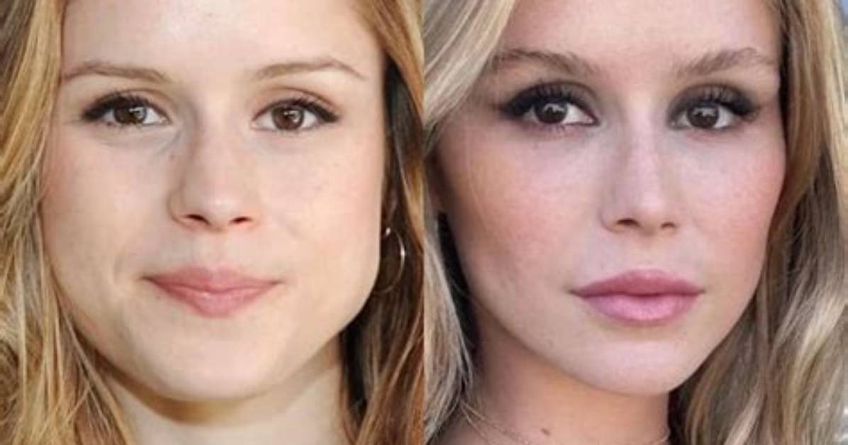 Erin Moriarty Before and After Plastic Surgery: What Happened to Her Face & Has She Lost Weight?