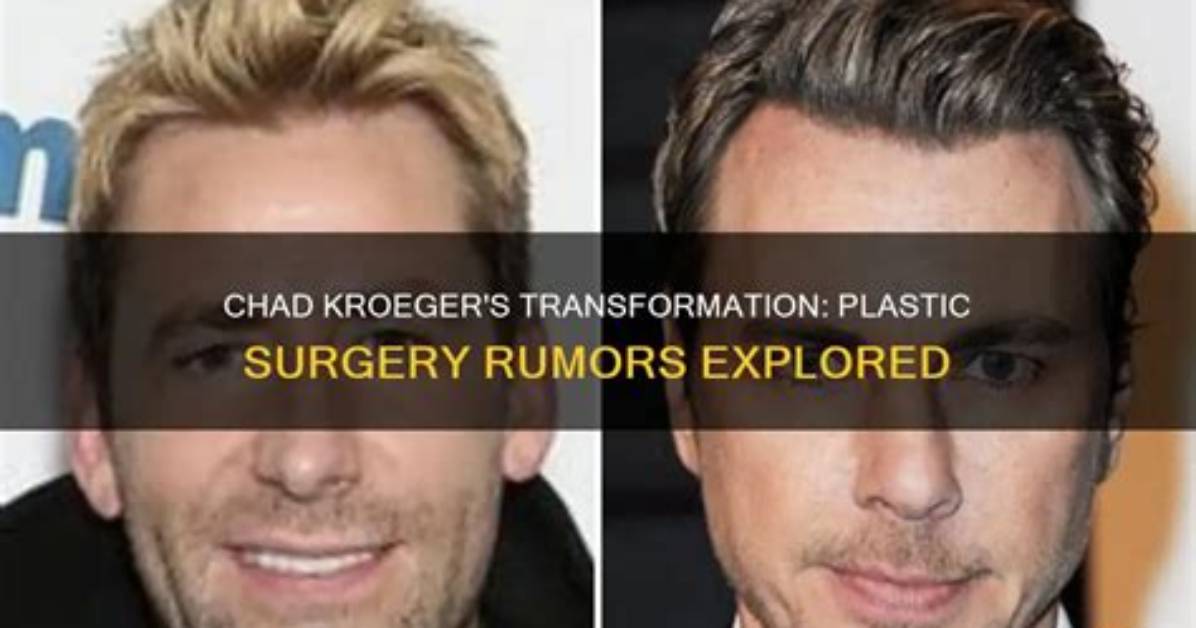 Essential Chad Kroeger Surgery Guide: Everything You Need to Know