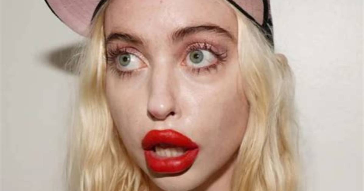 Euphoria’s Chloe Cherry’s Lips Have Been Creating Some Buzz After the Latest Episode, Here Is What She Looked Life Before Fillers