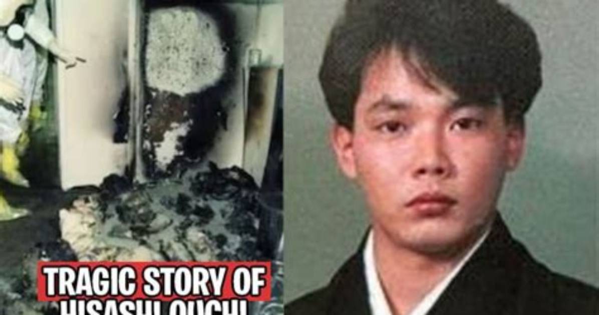 Exploring the Tragic Story of Hisashi Ouchi's Skin: a Journey Through Pain and Resilience