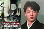 Exploring the Tragic Story of Hisashi Ouchi's Skin: a Journey Through Pain and Resilience