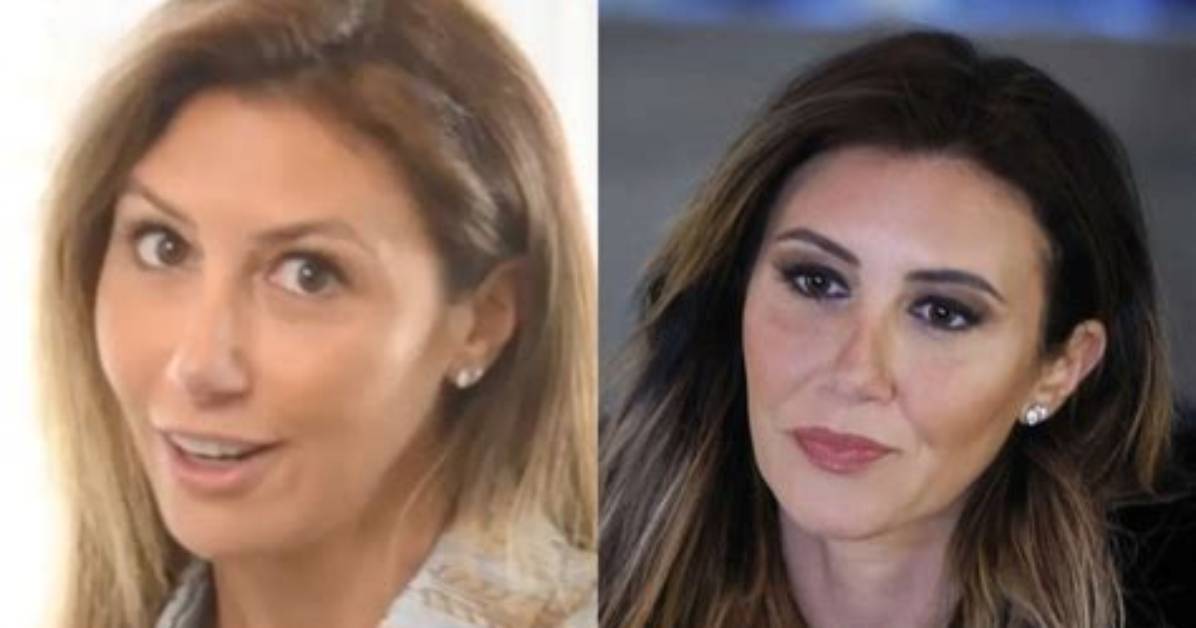 Exploring the Transformation: Alina Habba Plastic Surgery
