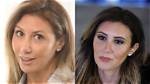 Exploring the Transformation: Alina Habba Plastic Surgery