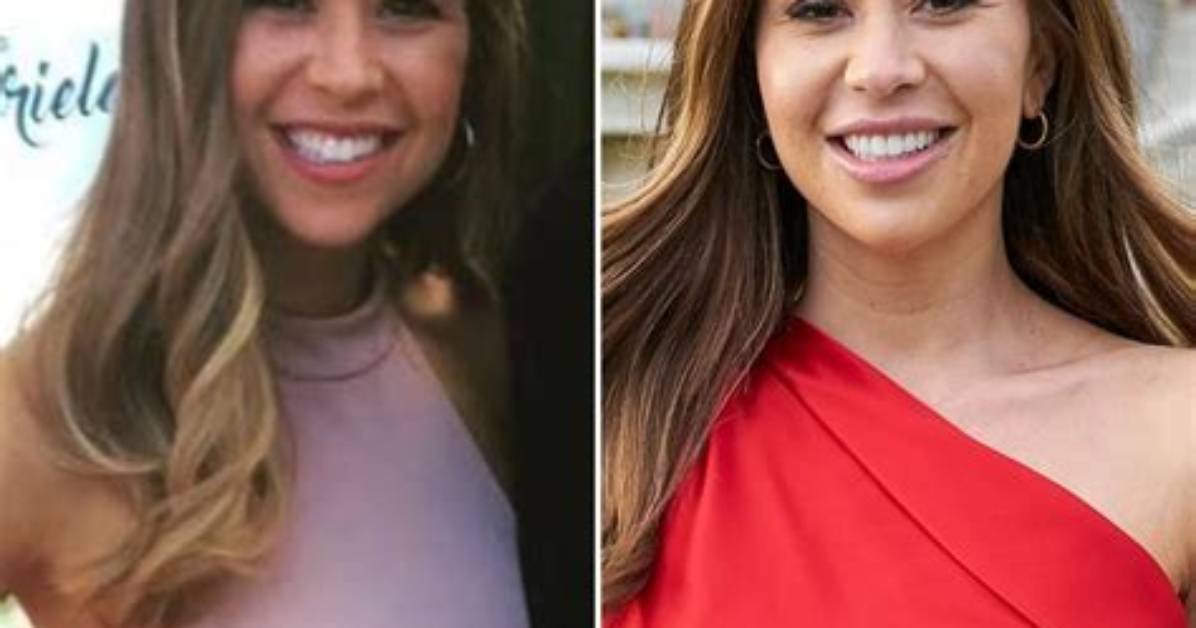 Gabby Windey Before and After Plastic Surgery: the Transformation Story