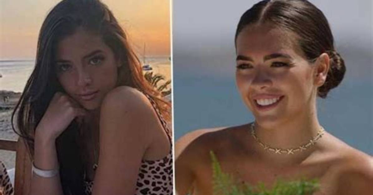 Gemma Owen Plastic Surgery Trending on Tiktok: Before and After Photo