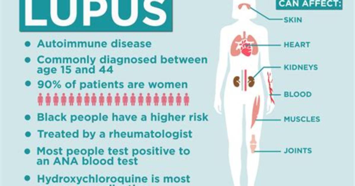 Get the Facts: Lupus and Ozempic's Impact