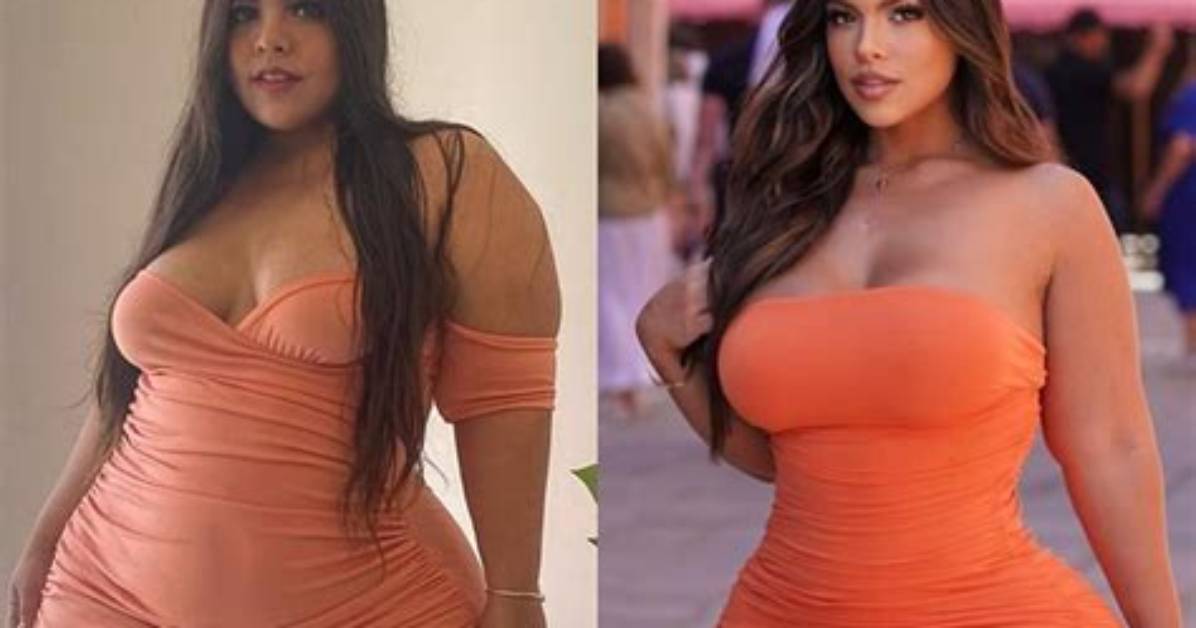 Gracie Bond Before and After: Transformation Journey