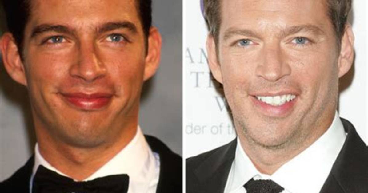 Harry Connick Jr's Stroke in 2019: a Journey of Resilience
