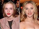 Has Scarlett Johansson Had Plastic Surgery? Truth Revealed Here