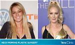 Heidi Montag Plastic Surgery: Before and After Transformation