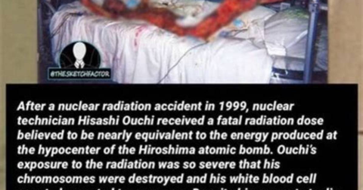 Hisachi Ouchi: a Journey Beyond Radiation