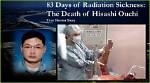 Hisashi Ouchi: a Tale of Survival and Medical Intrigue