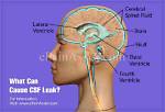 How They Can Leak into Your Brain