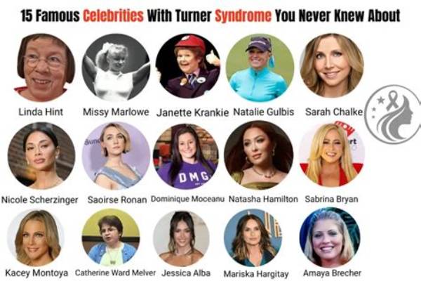 Inspiring Lives: Turner Syndrome Celebrities Who Redefine Beauty