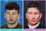 Intriguing Speculations: Has Barry Keoghan Embraced Cosmetic Enhancements?