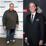 Is Billy Gardell Sick? Did He Undergo Bariatric Surgery? Details to Know