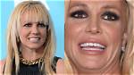 Is Britney Spears on Meth, What Happened to Her Teeth? Addiction and Condition