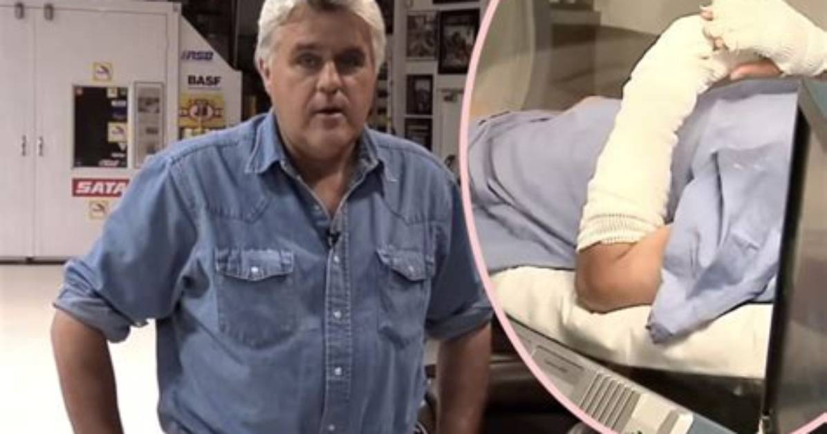 Jay Leno Stated That He Is Recovering Well After Being Injured in a Fire Incident