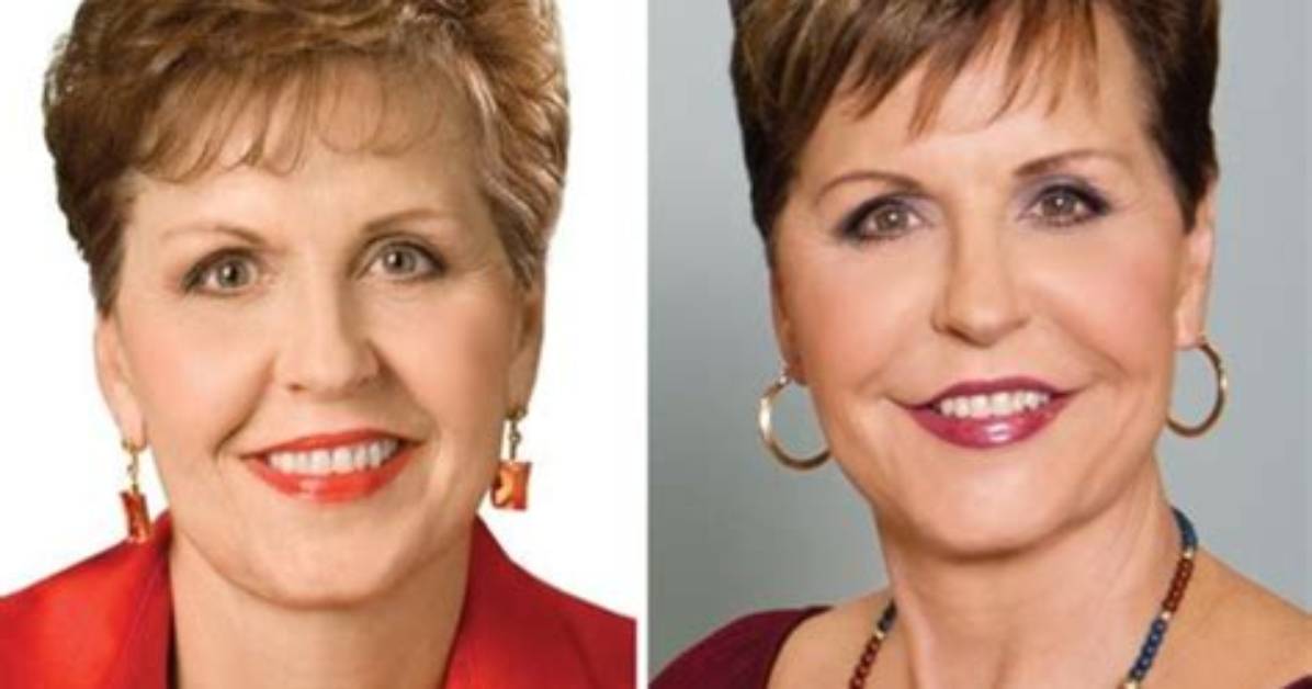 Joyce Meyer's Plastic Surgery Journey and Its Impact