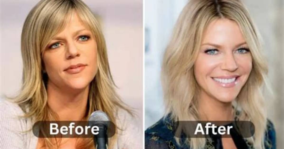 Kaitlin Olson Plastic Surgery as Dee from Always Sunny