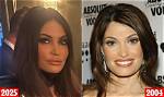 Kimberly Guilfoyle: a Journey Through Pre-Surgery Transformation