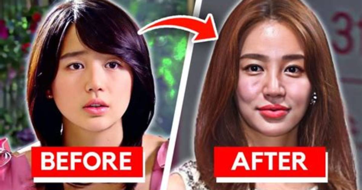 Korean Actress Plastic Surgery Gone Wrong: a Closer Look