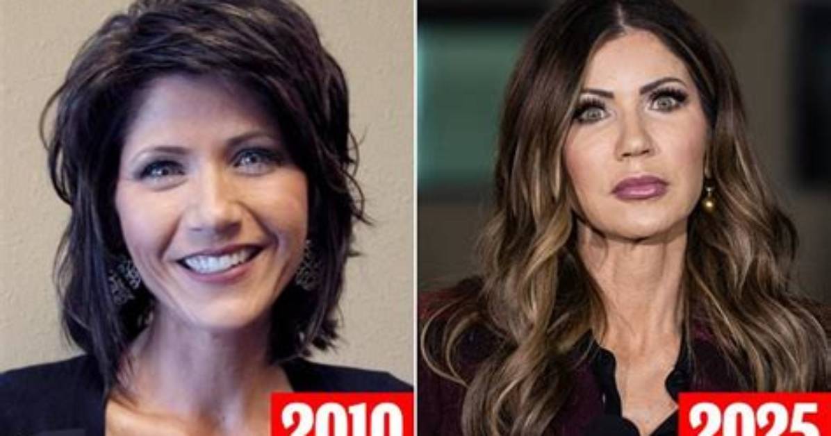 Kristi Noem: the Journey of Transformation Through Plastic Surgery