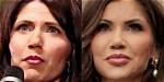 Kristie Noem's Alleged Plastic Surgery: a Comprehensive Analysis