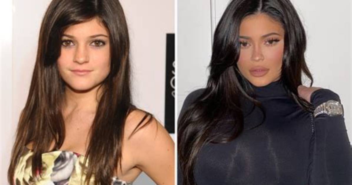 Kylie Jenner's Body Transformation: a Look Ahead to 2024