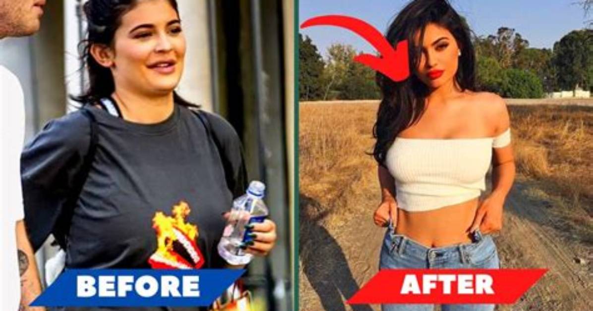 Kylie Jenner's Weight Journey: Predictions and Updates for 2024